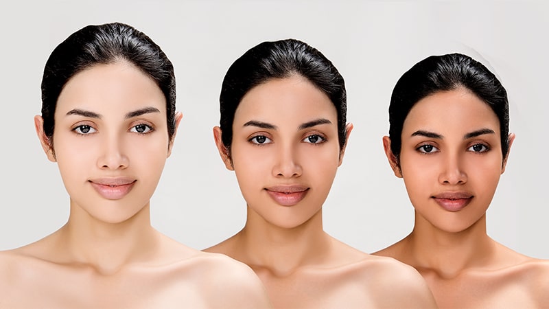 Entdecken Sie jalupro bei MorySkin – Faire Preise für Premium Dermal Filler